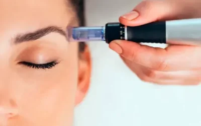 Dermapen: ciencia y arte para una piel visiblemente renovada